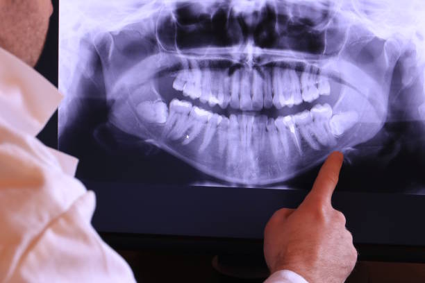 Best Pediatric Emergency Dentist in Olivet, NJ